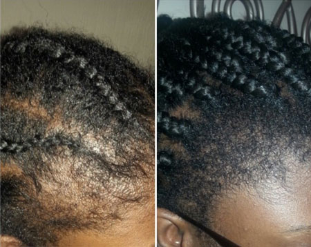 3 Best Jamaican Black Castor Oils For Hair Growth That Really Work