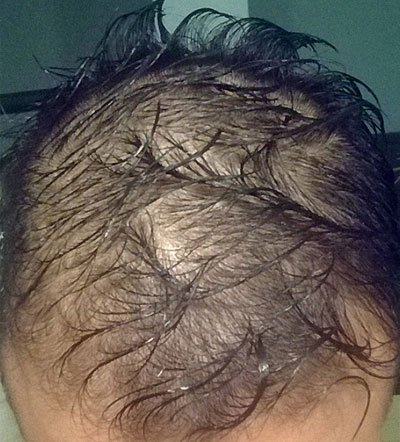 best hair thickening products for instant results before