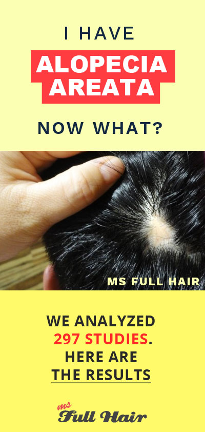 what"s the best alopecia areata treatment?