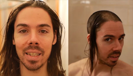 How I Reversed Hair Thinning On Top Of Head Another Success Story