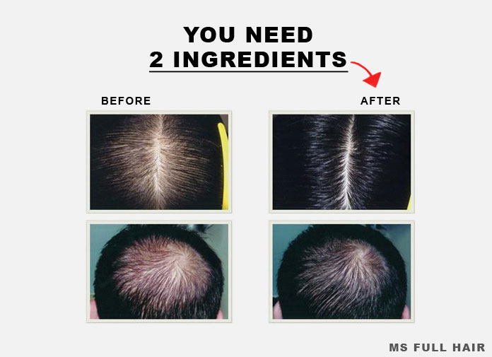 Reviews For Best Hair Loss Regrowth Growth Products Thinning How To Accelerate Hair Growth According Anese Researchers