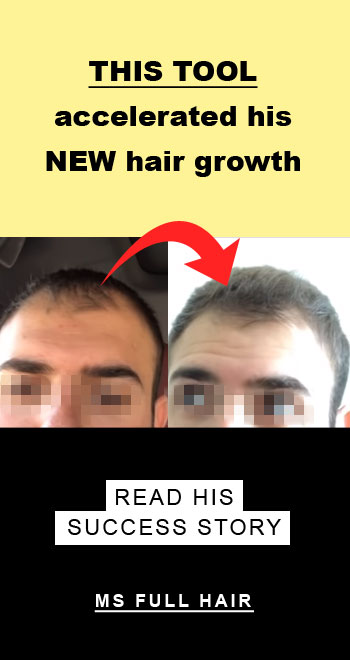 inositol-hair-growth-reddit